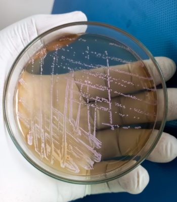 E coli colonies, Gram negative Rods, GNR colonies as test on Sal
